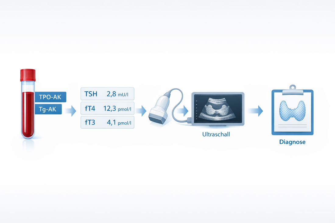 Hashimoto-Diagnose: Indikation, Laborparameter und Sonographie